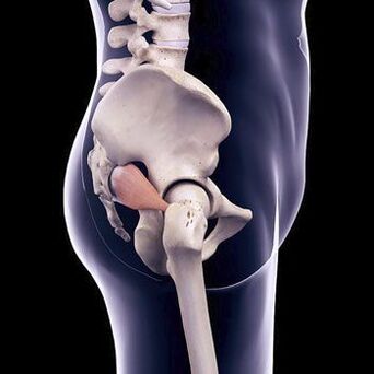 Dagger back pain may be due to spasm of the piriformis muscle