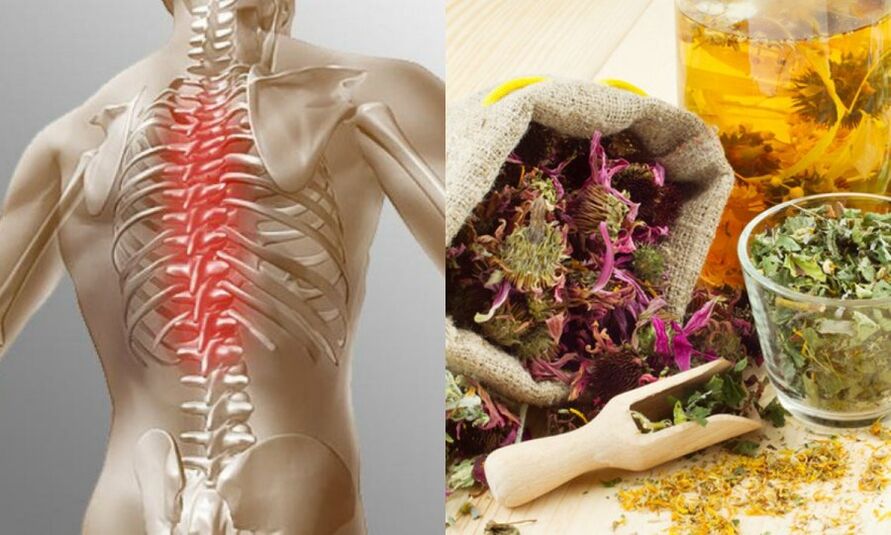 Traditional recipes - preventing the development of osteochondrosis and promoting spinal health