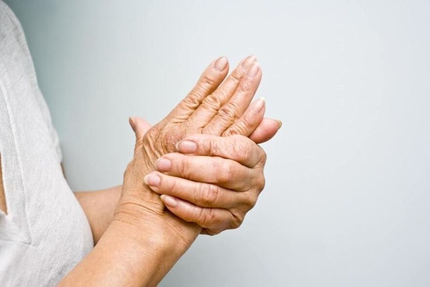 how to diagnose osteoarthritis