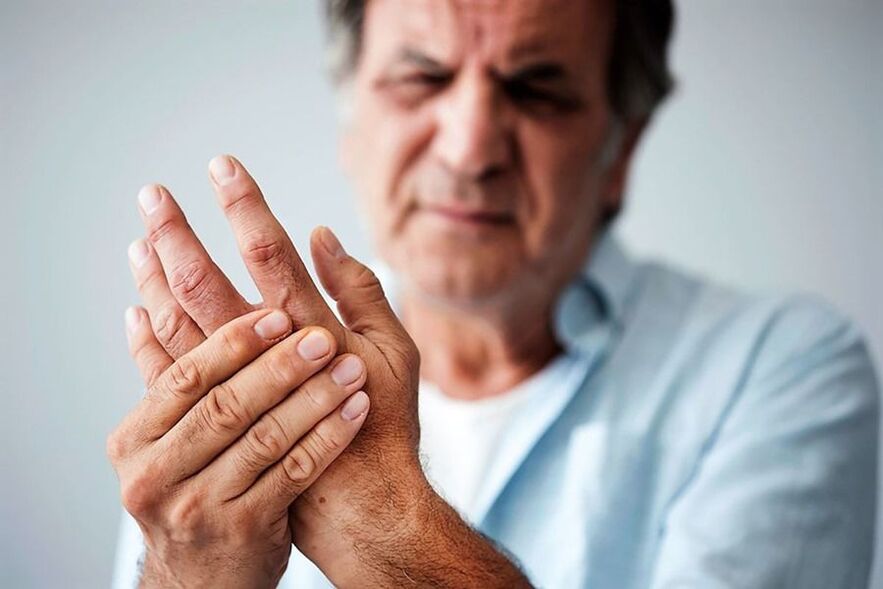 signs of hand osteoarthritis