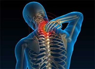 Pain in the neck is a common symptom of osteochondrosis