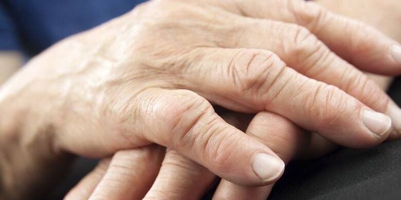 To what pathologies the finger joints hurt