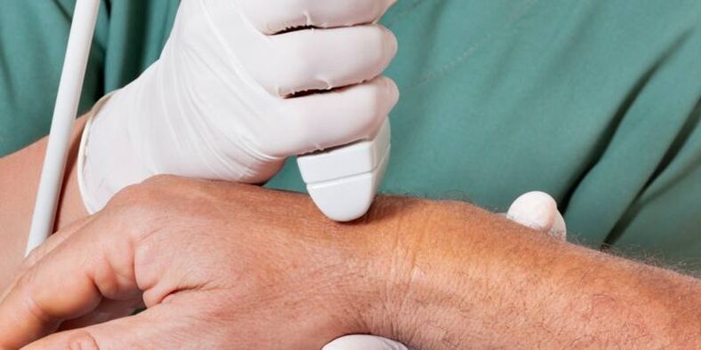 arthritis as causes of pain in finger joints